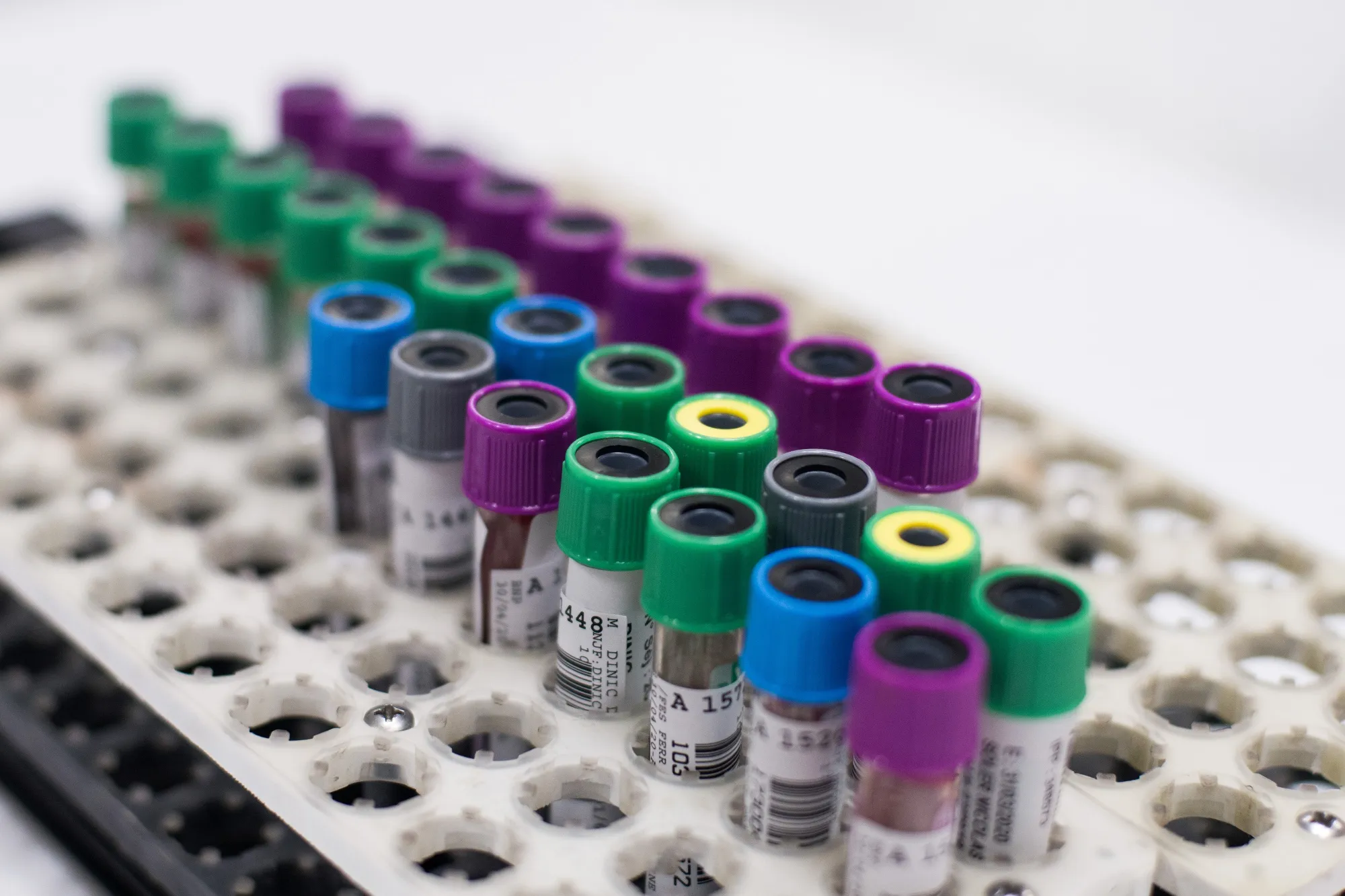 Empty vials sit in a rack inside the Unilabs Eylau coronavirus research and serology testing labs in the Neuilly-sur-Seine district of Paris, France, on Thursday, April 30, 2020. Deaths in France linked to the coronavirus rose at the slowest pace in four days on Thursday, with the country reporting fewer than 300 fatalities for the second time this month.