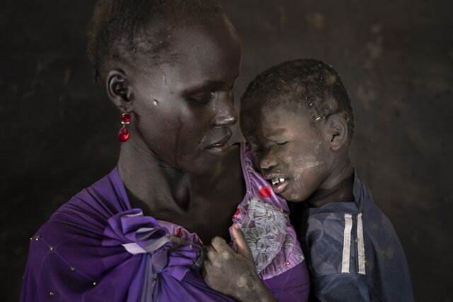 Nyachianya Duoth holds her son, Kai, in Mirmir village, Koch County. In April 2020, she gave birth to Kai, who was born with no eyes. Nyachianya said, “The doctor told us this deformity had occurred because of where we live near to the oil companies,”.