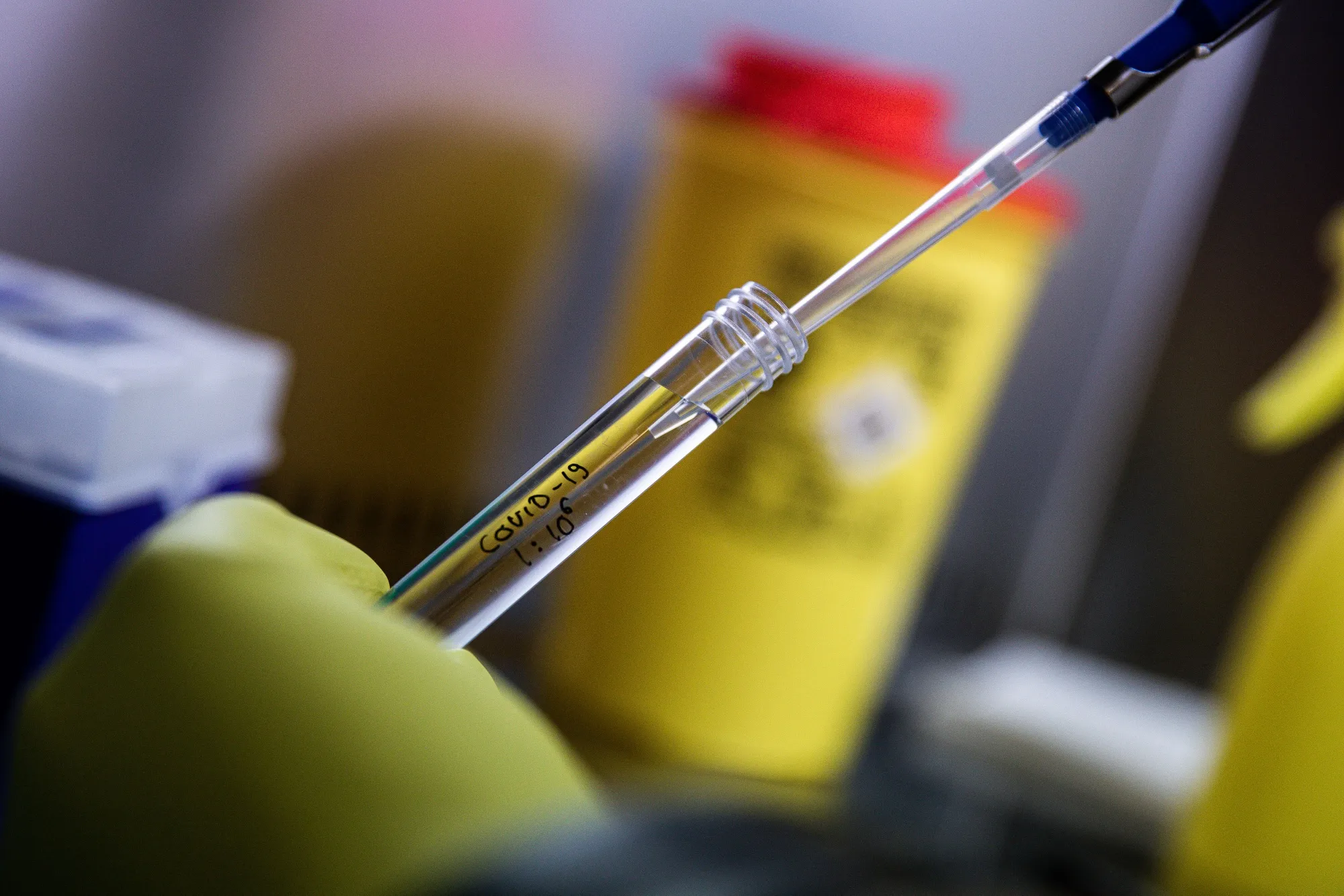Hungarian Coronavirus Testing At University of Pecs Szentágothai Research Center 