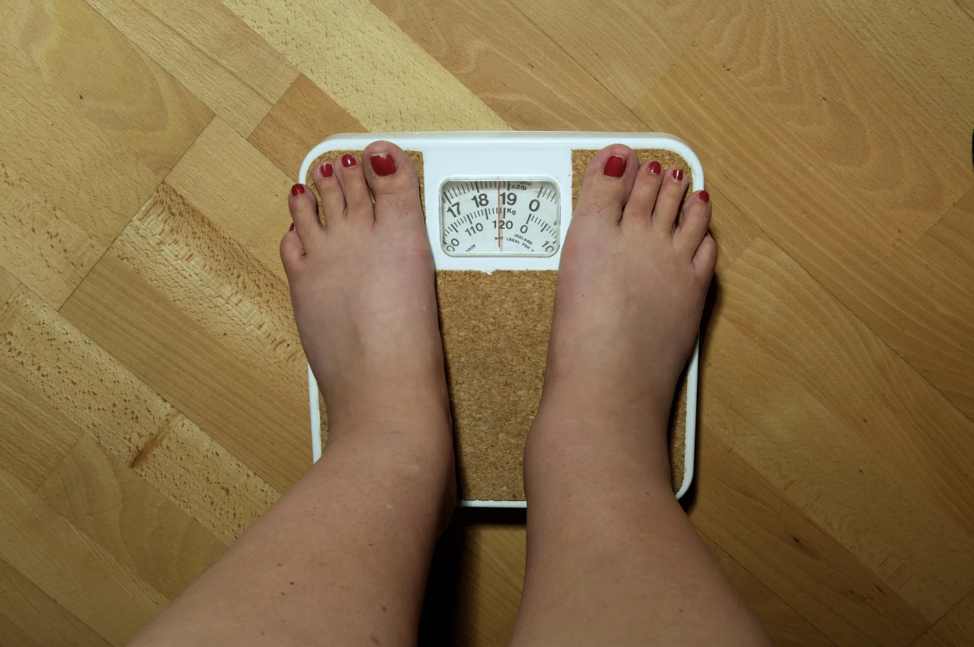 Gastric Band Treatment