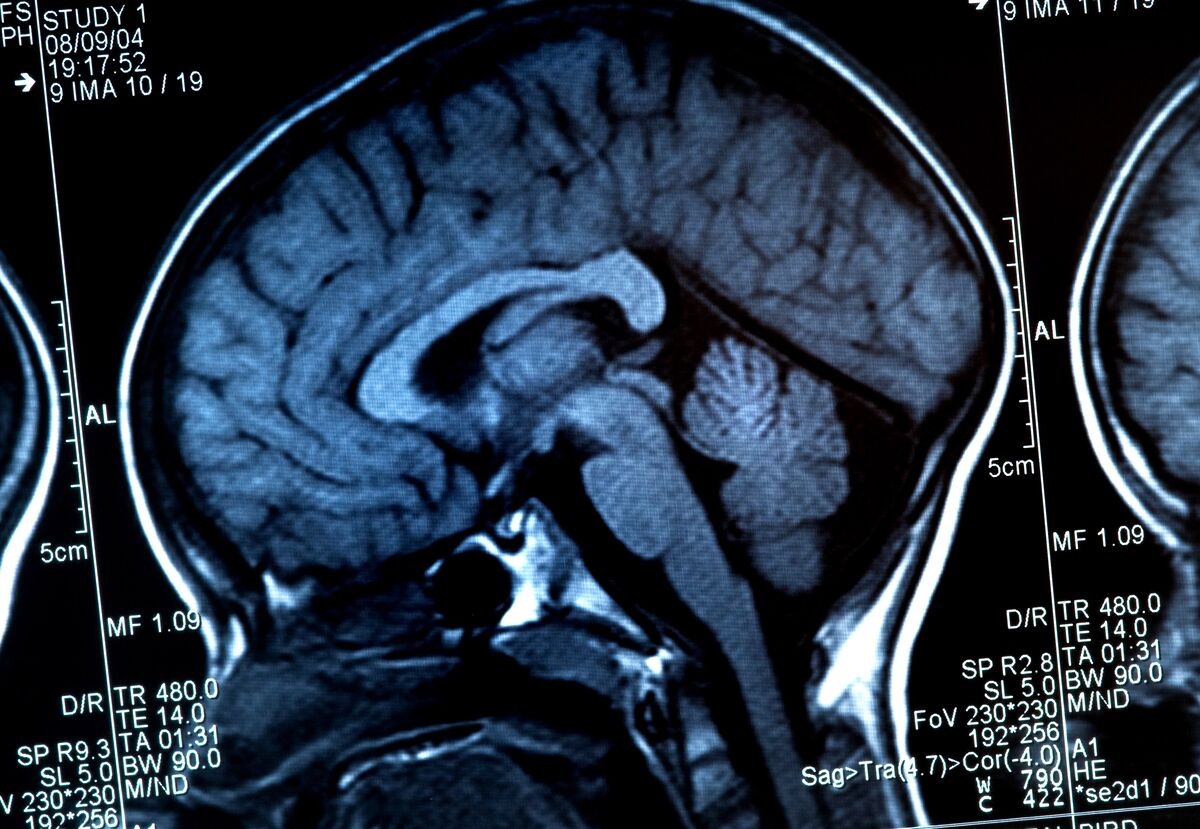 ⚫️ BLOOMBERG: Lumexa Imaging Holdings Inc. presenta domanda per IPO con ricavi in crescita e perdite in calo