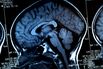 RF brain skull scan xray mri chart