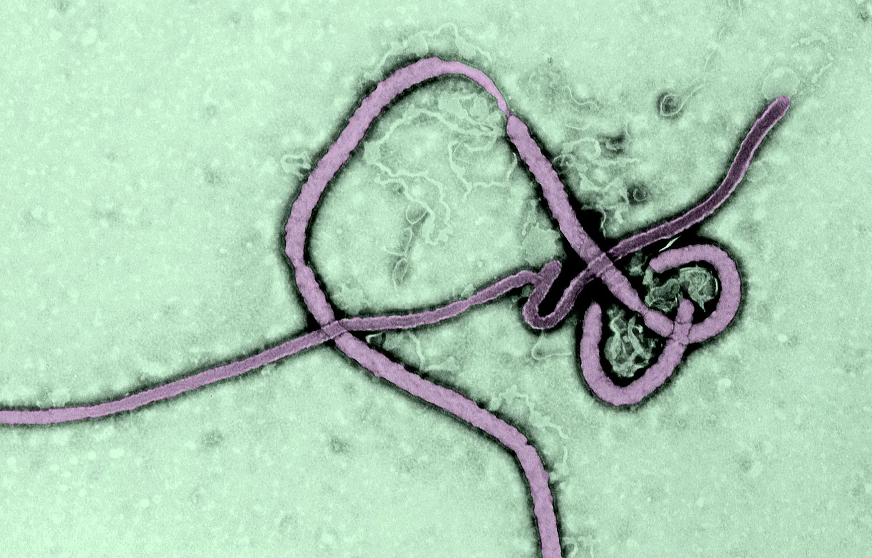 A Transmission Electron Micrograph (TEM) of the Ebola virus.

