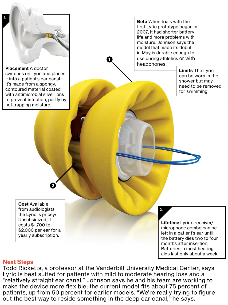 Lyric Hearing Aid Works Overtime