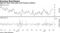 QQQ ETF short sales spike amid frequent outflows