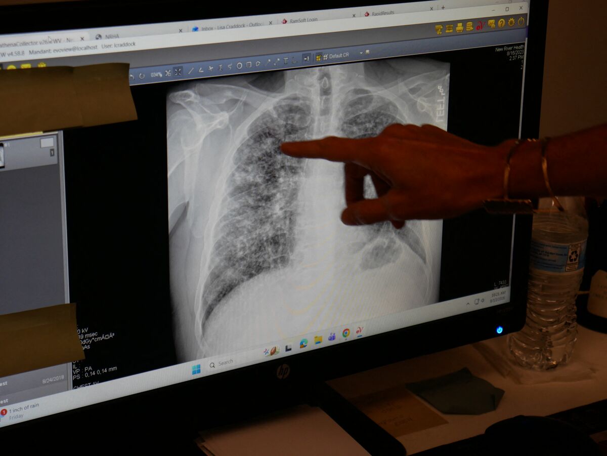 bloomberg.com - Mark Gongloff - Black Lung Disease Is the Only True Comeback for Coal