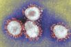 Coronavirus, Tem