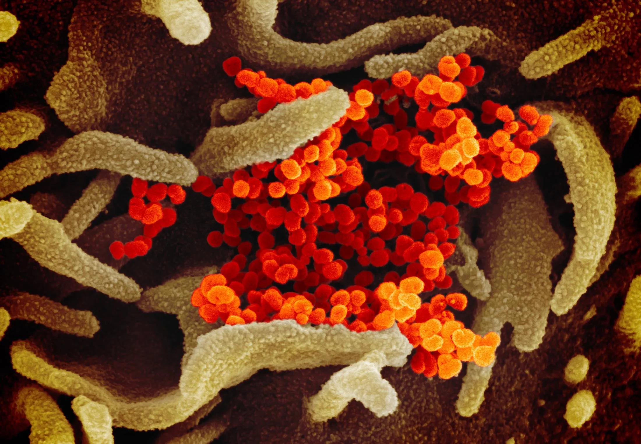 This scanning electron microscope image shows coronavirus cultured in the lab.