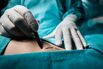 Close up of a doctor marking the human skin.