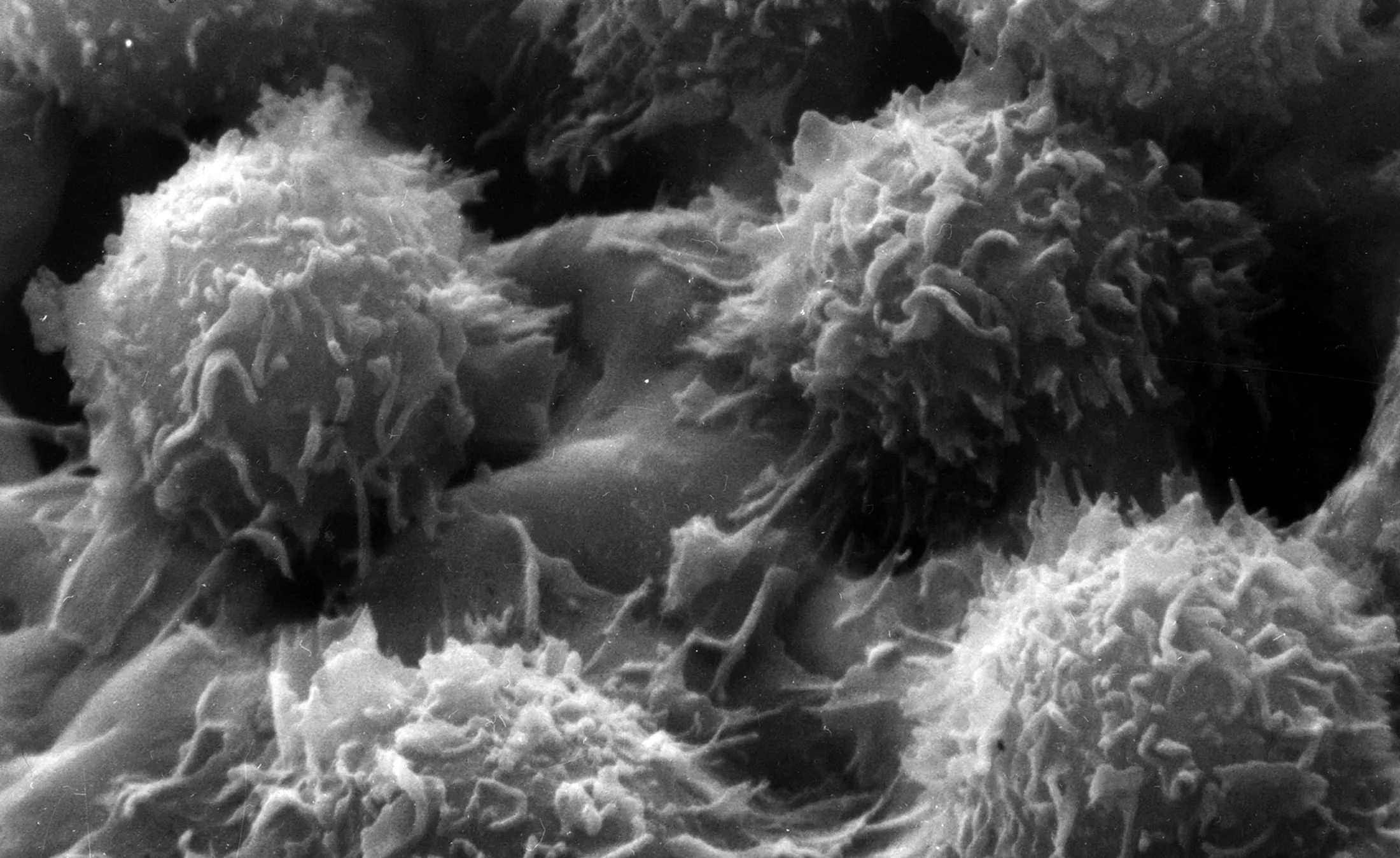 Leukemia cells
