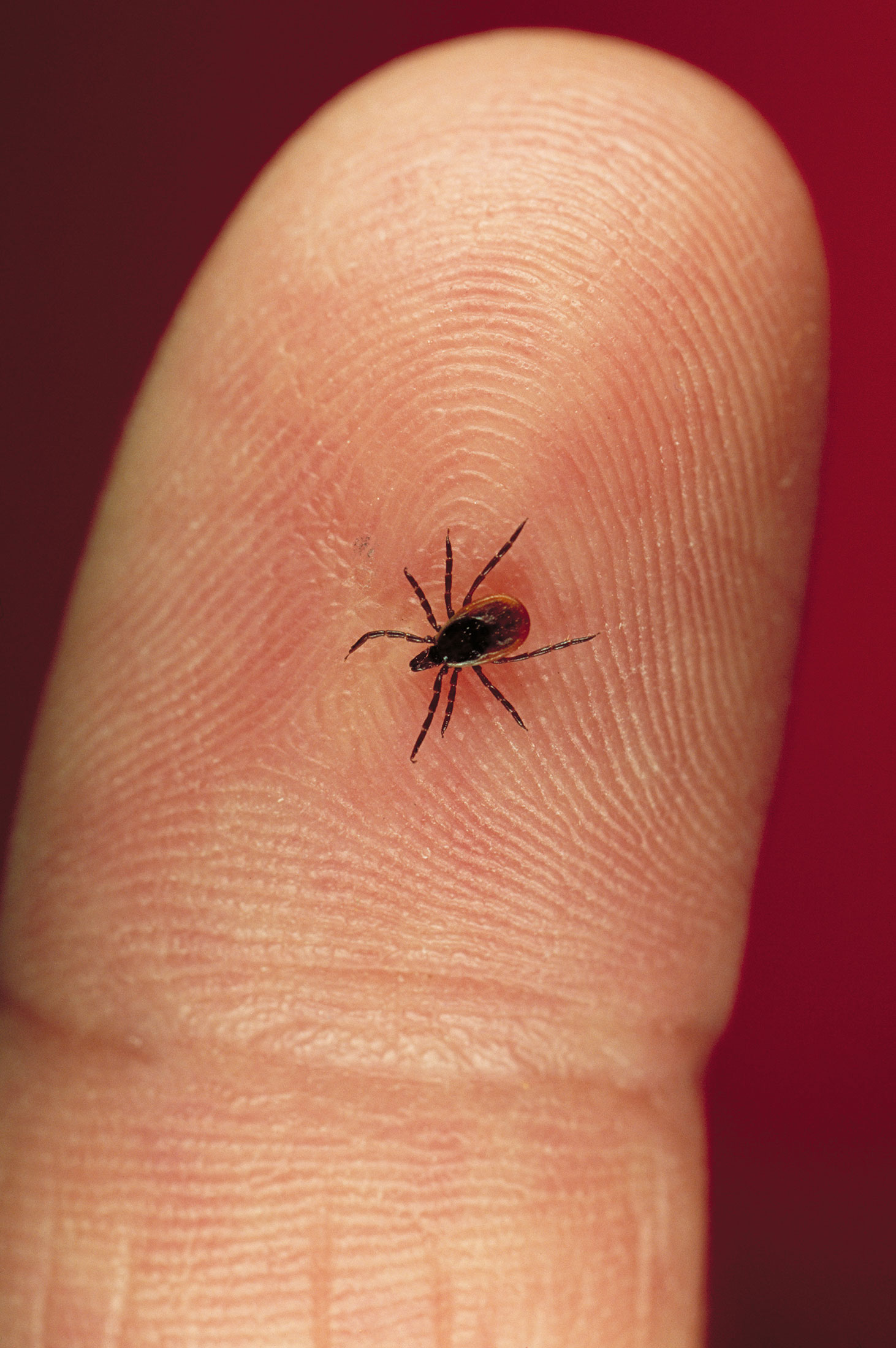 Lyme Disease Dubious Alternative Treatments Are Killing Patients