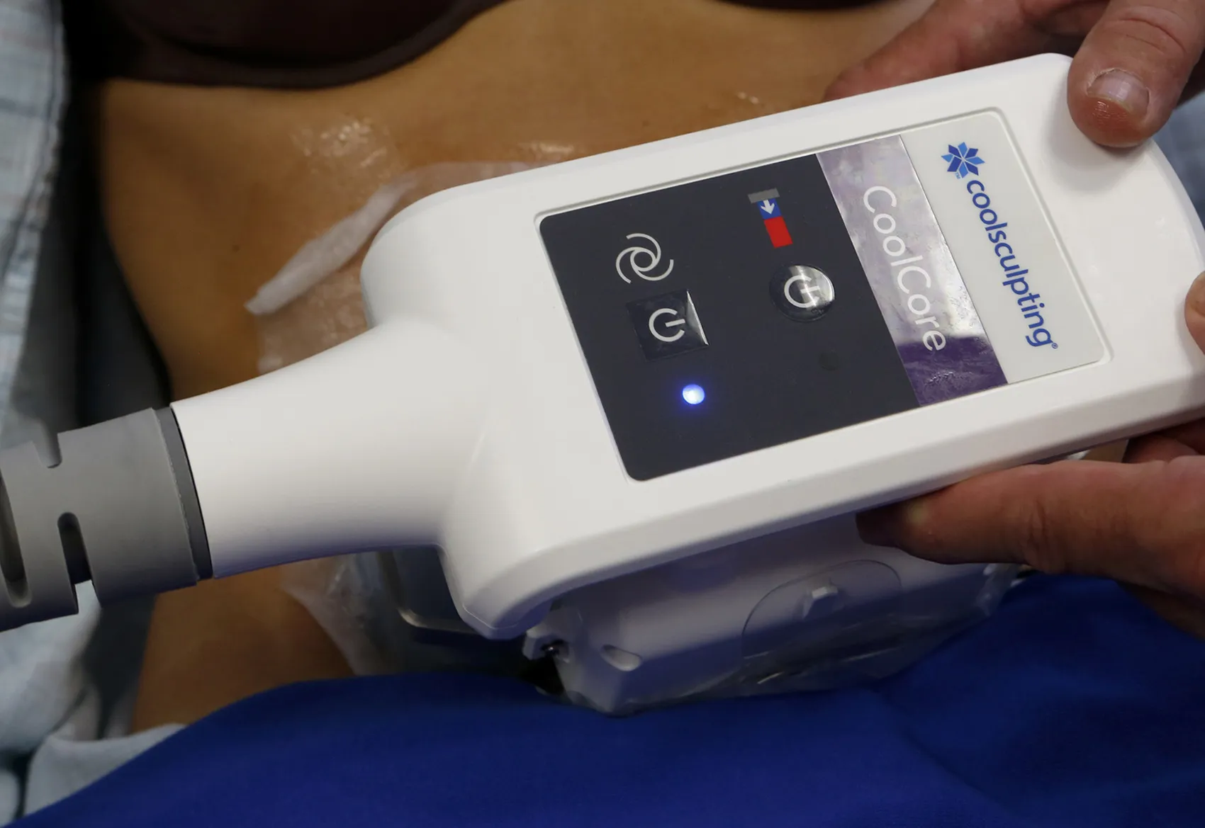 A doctor holds an instrument used in CoolSculpting in Los Angeles.
