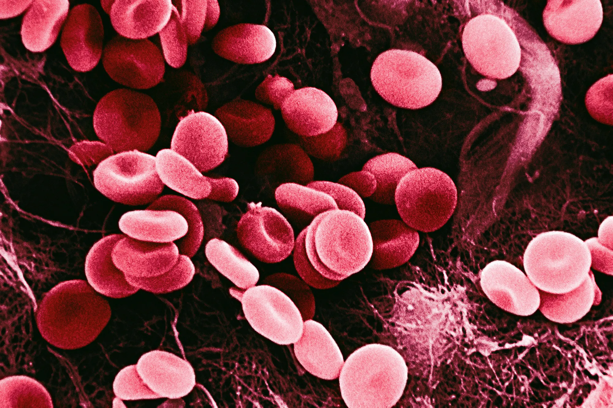 Red blood cells form a clot.&nbsp;