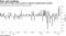 Virus panic brings record surges in negative-yielding debt stockpile