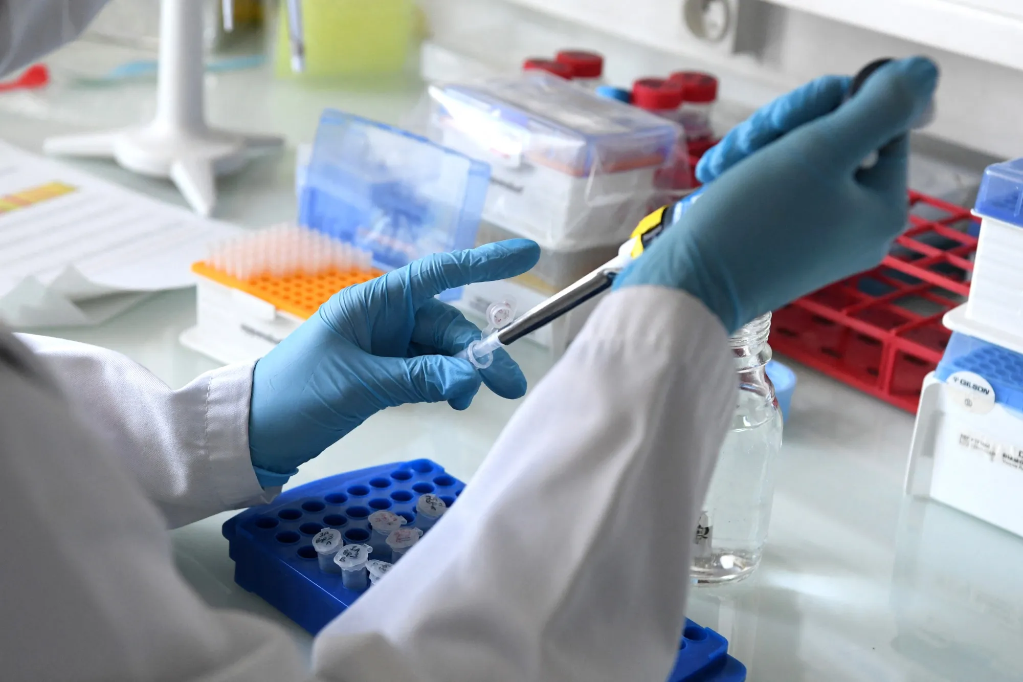 Laboratory close-up of a scientist using a pipette and sample tubes, representing biomedical research.