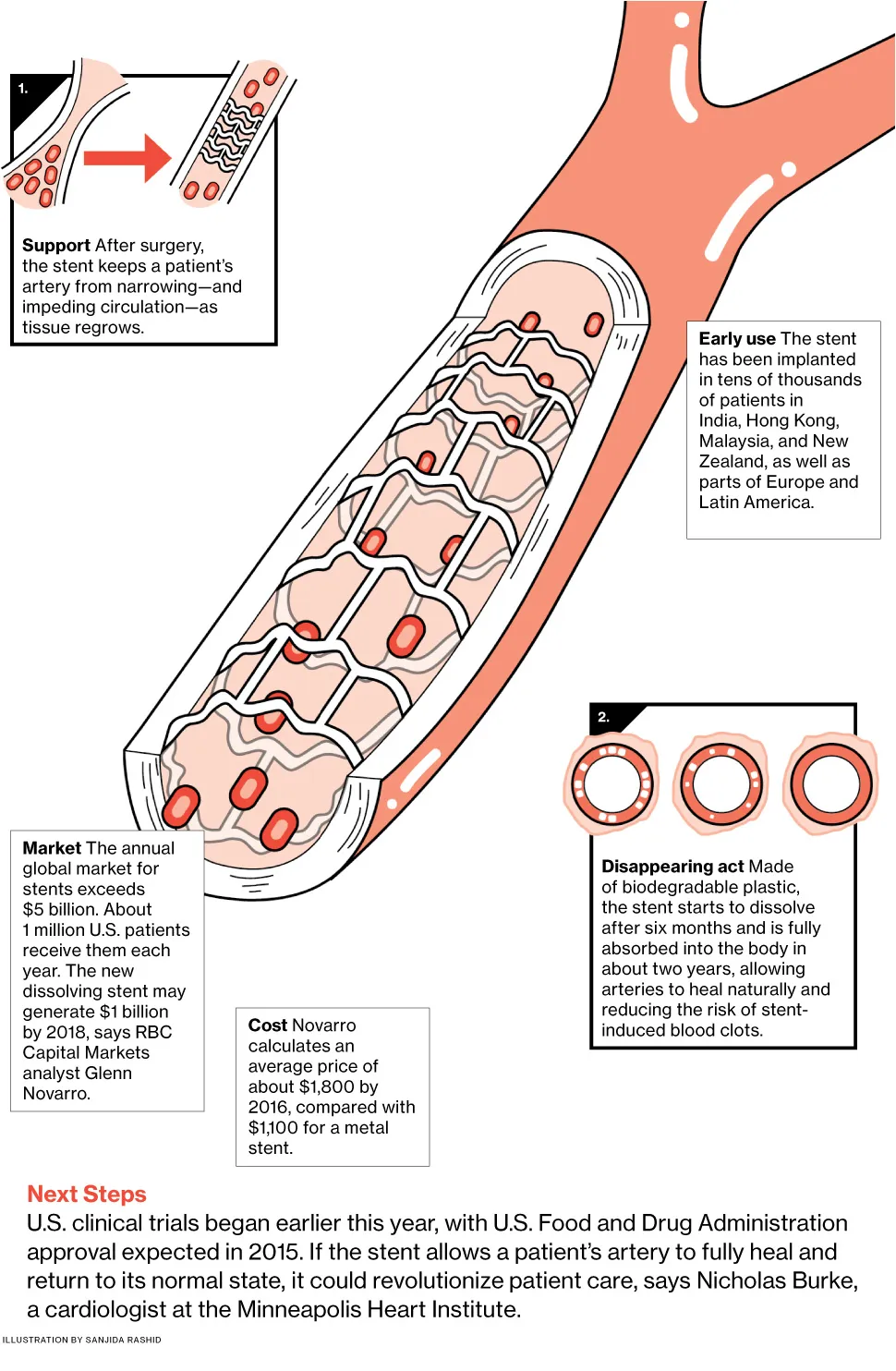 Abbott Labs' Dissolving Heart Stent Helps Improve Recovery