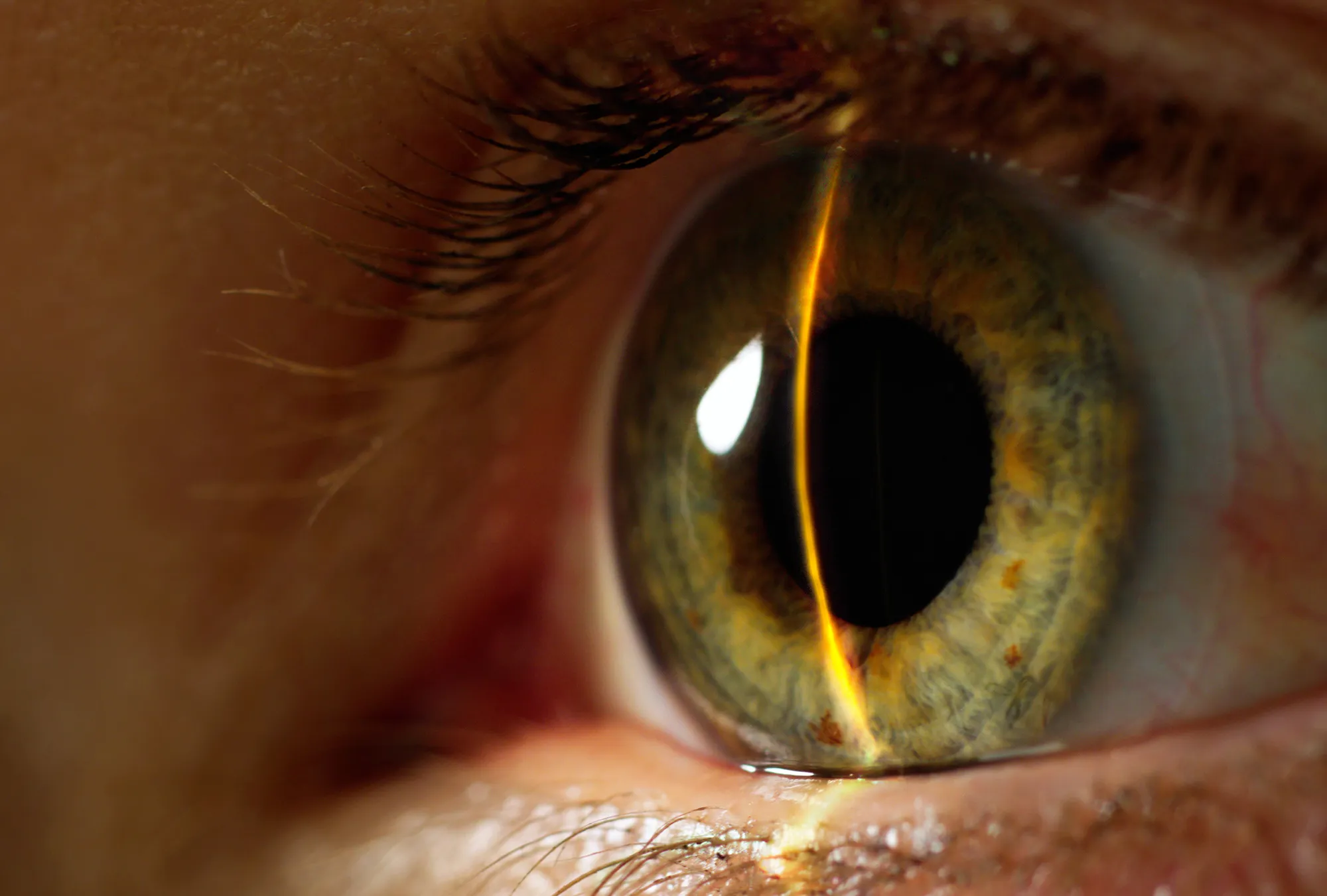 RF eye scan retinal