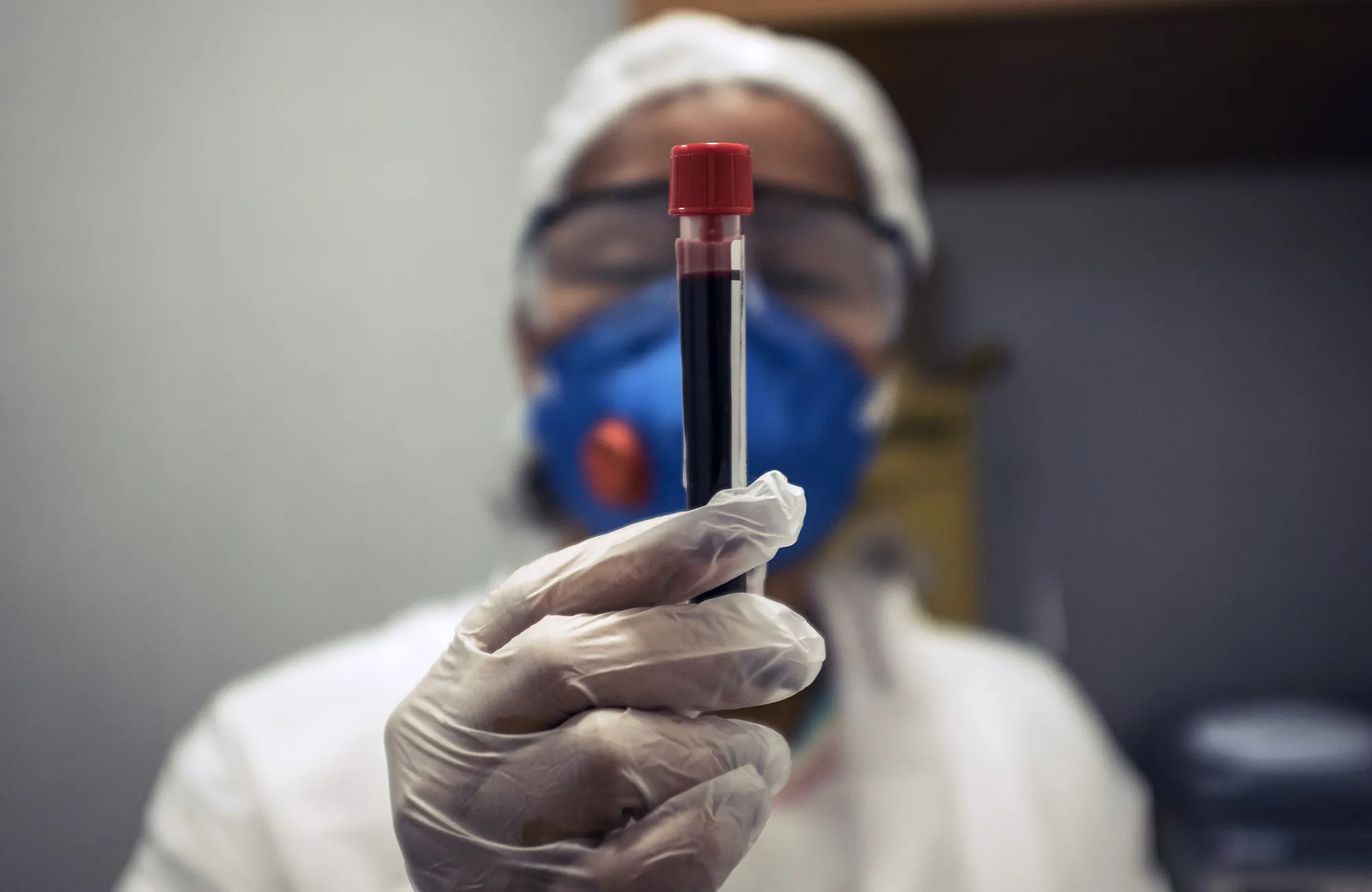 BRAZIL-HEALTH-VIRUS-TESTING