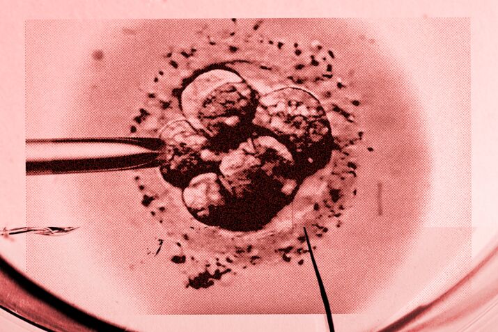 IVF Disrupted, The Kindbody Story: The Baby Project