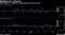 Both QQQ and TQQQ saw huge inflows late last week