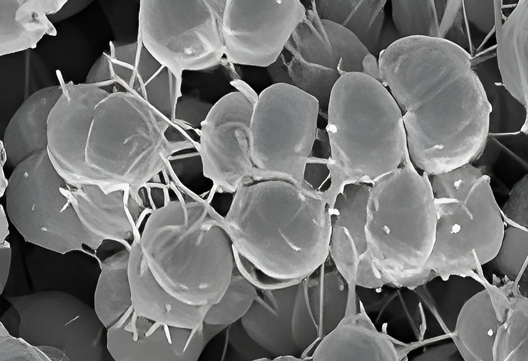 Phenotypic variants of Neisseria gonorrhoeae bacteria.