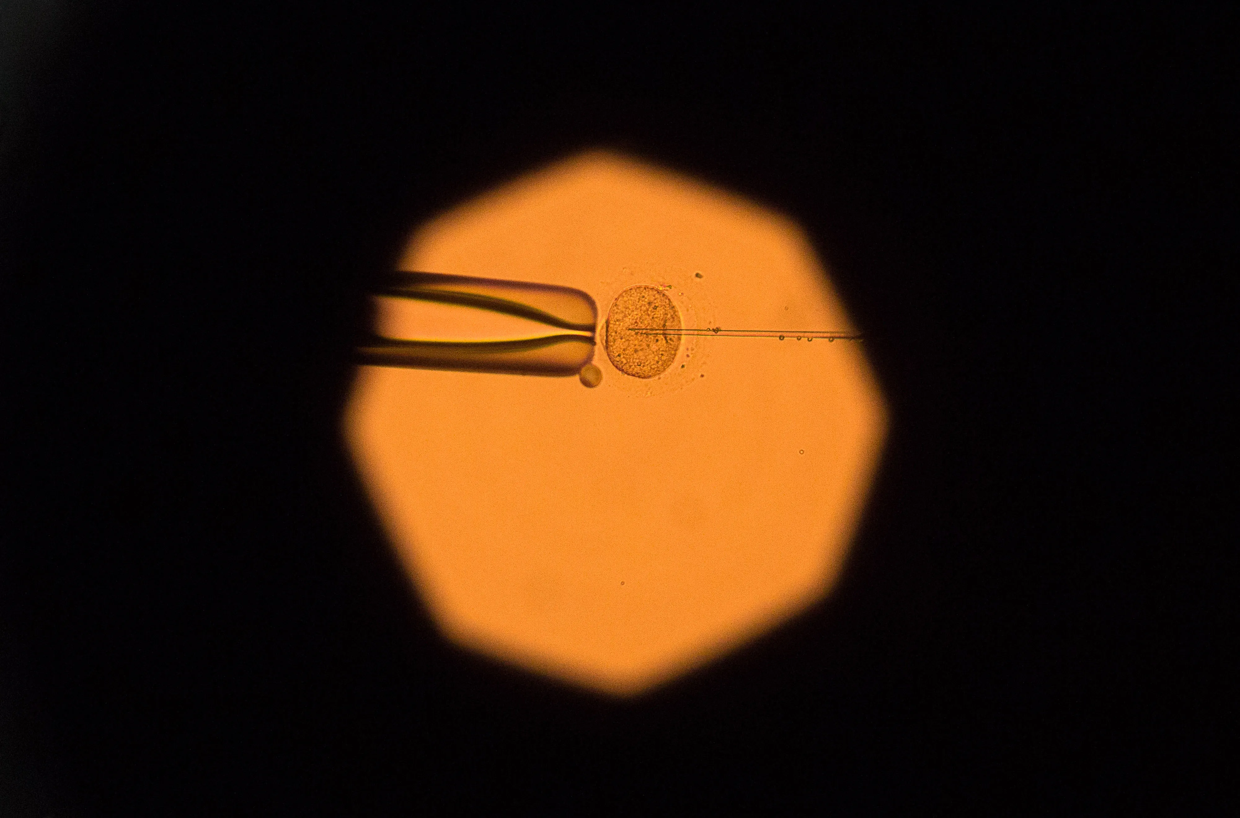 An image from an electron microscope shows oocyte manipulation.