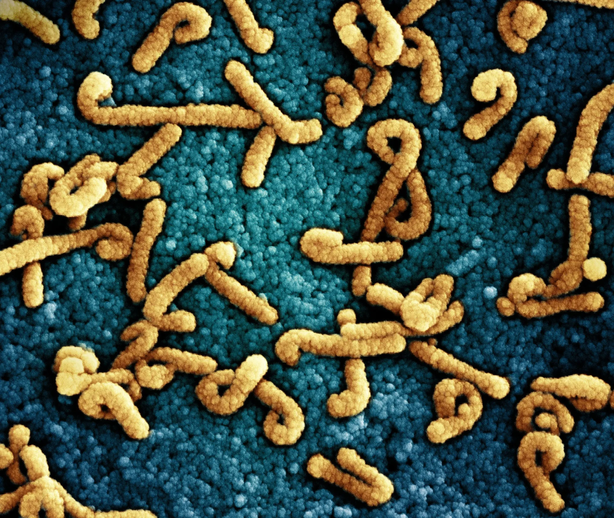 Colorized scanning electron micrograph of Marburg virus particles.