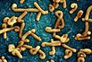 Colorized scanning electron micrograph of Marburg virus particles