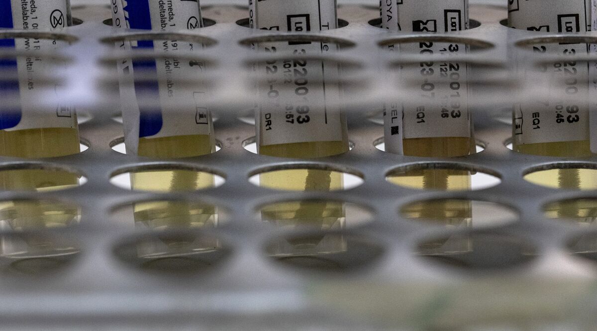 Monkeypox Cases NYC Says 62 People Presumed to Have Tested Positive