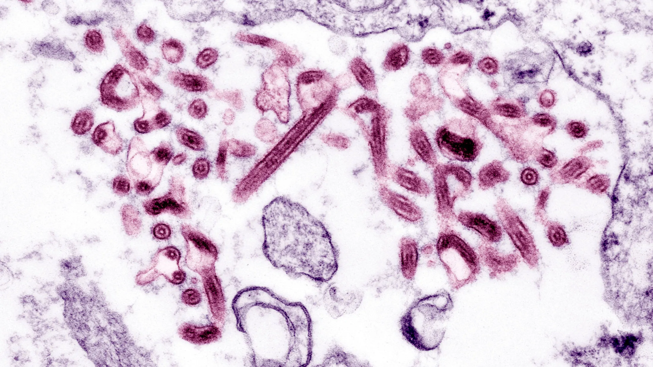 Electron Micrograph of the Ebola virus.
