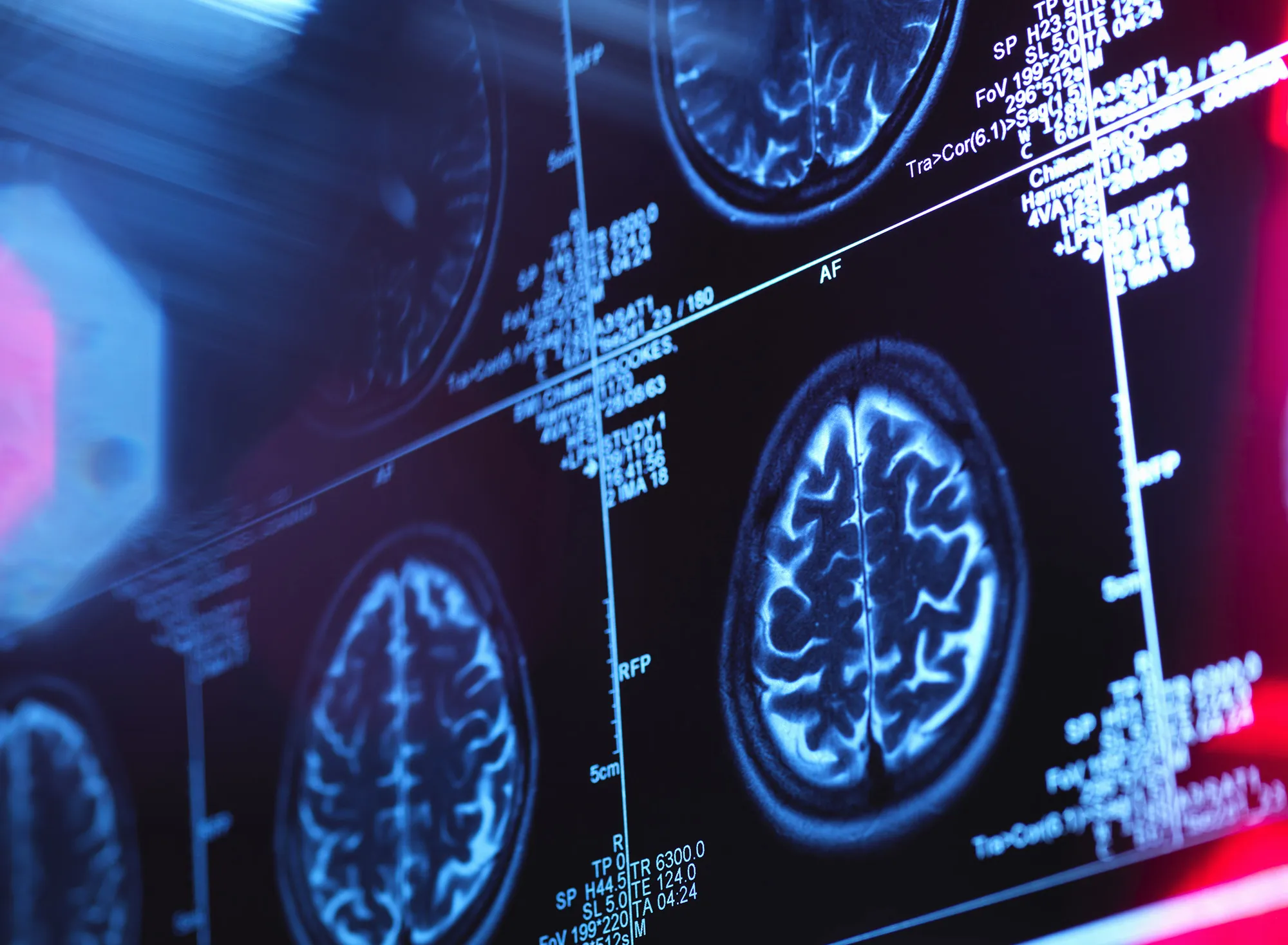 U.K. research makes a strong argument for aiming for zero cases.