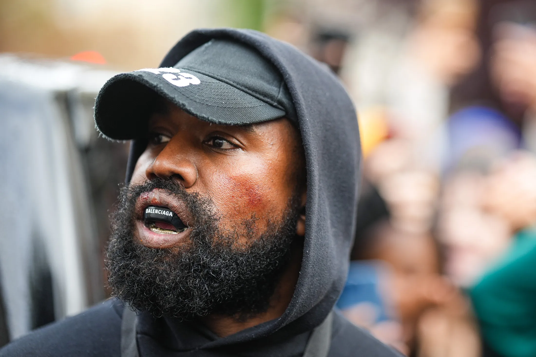 Kanye West wearing a Balenciaga mouthguard during Paris Fashion Week on Oct. 2.