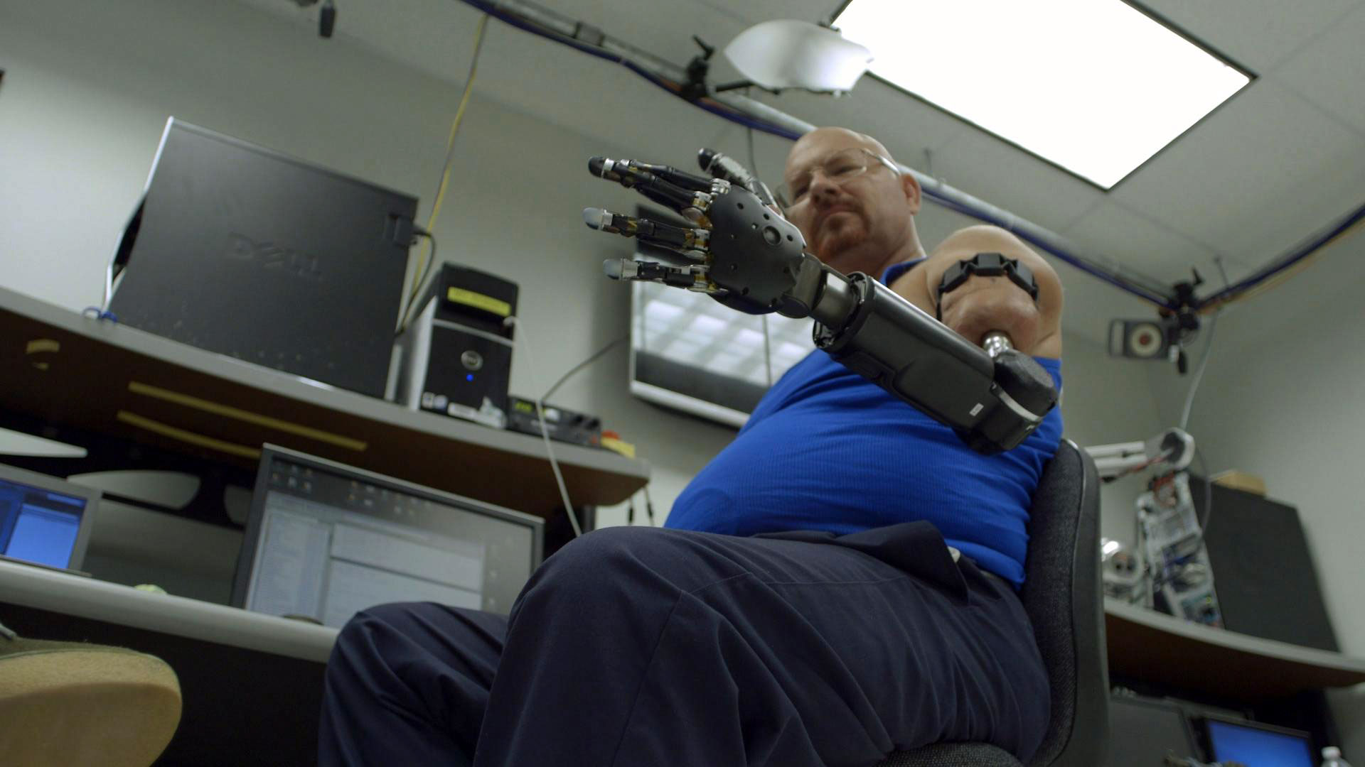 A Prosthetic Arm That Gives Amputees the Sense of Touch - Bloomberg