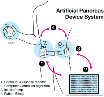 relates to Patient Hurt by Do-It-Yourself Artificial Pancreas Prompts FDA Warning