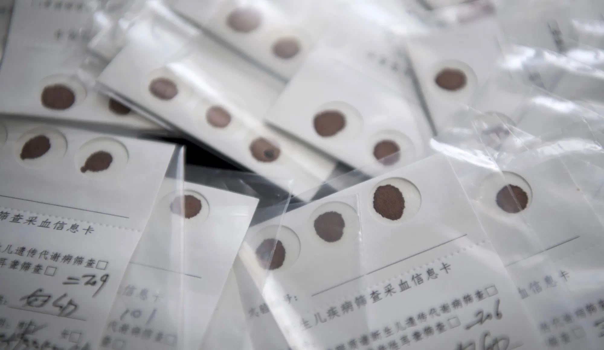 Blood samples of newborn infants are collected for disease screening at&nbsp;a&nbsp;lab&nbsp;in Taiyuan city, north China's Shanxi province.&nbsp;