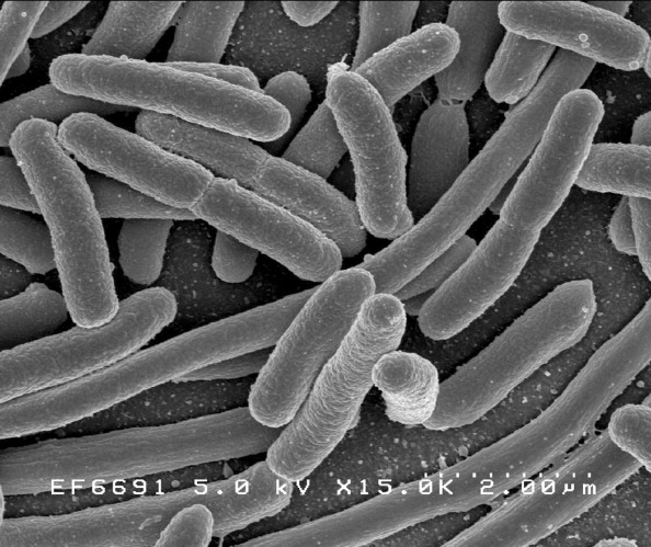 E. coli, master of self-defense.

