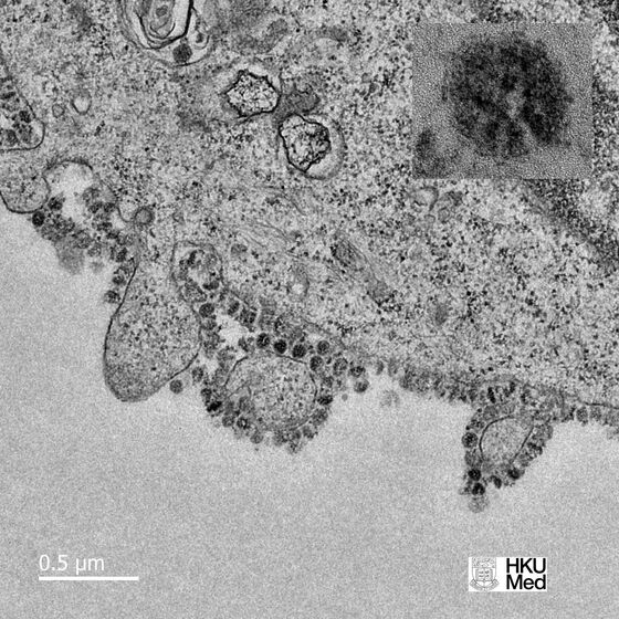 Here Are the First Images of How Coronavirus Replicates in Cells