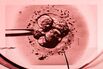 IVF Disrupted, The Kindbody Story: Fertility Care, Meet Sales Targets