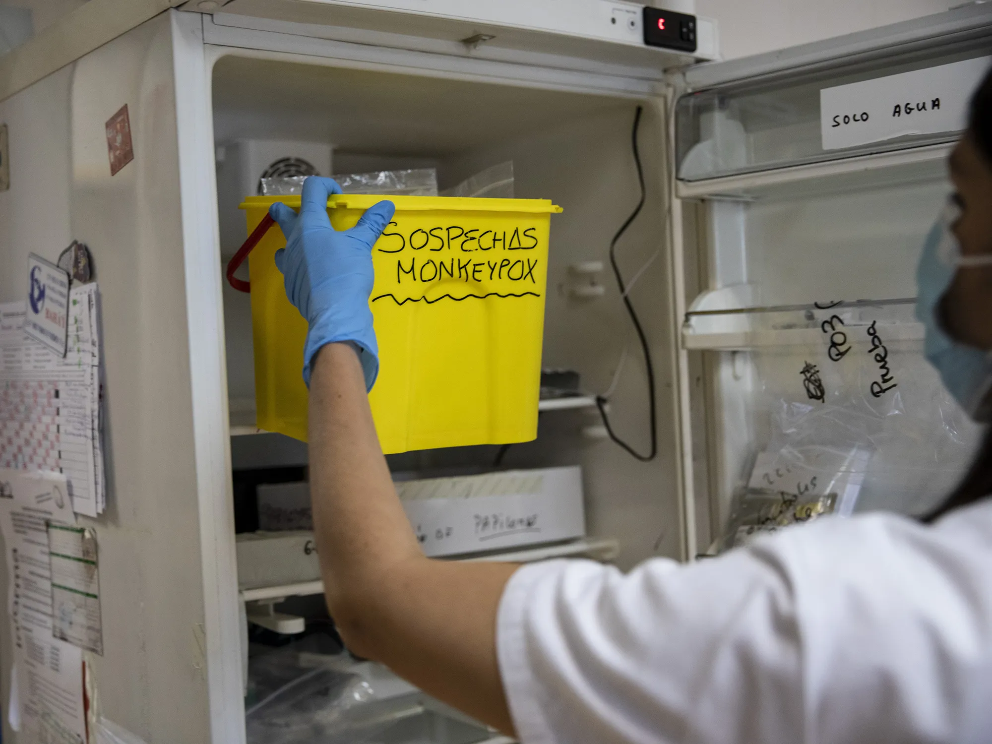 A laboratory technician picks up suspected monkeypox samples to be tested at the microbiology laboratory of La Paz Hospital&nbsp;in Madrid.&nbsp;
