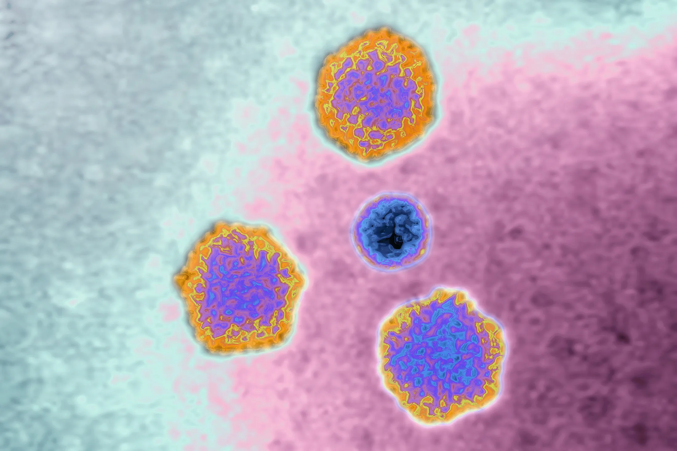 Adenovirus, one of the many causes of pneumonia.