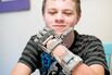 E-Nable’s 3D-Printed Prostheses for Kids
