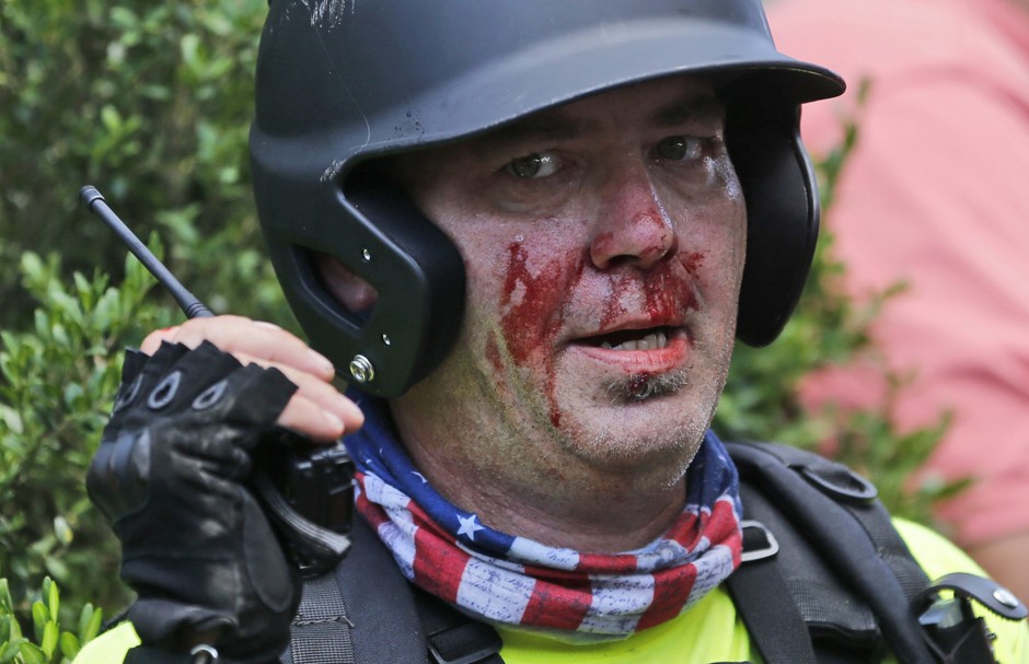 A white nationalist demonstrator, bloodied after a clash with a counter demonstrator, at the entrance to Emancipation Park in Charlottesville, Virginia.