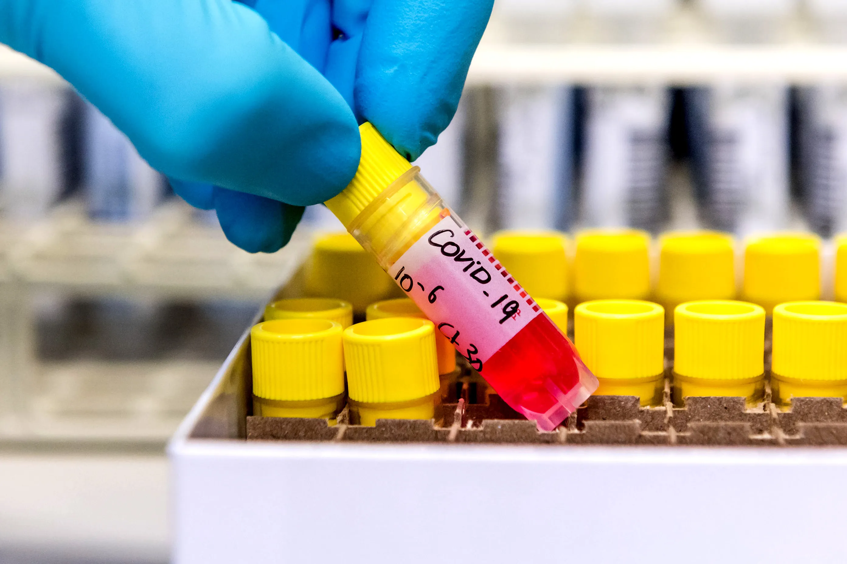 Patients won't see a coronavirus treatment in the coming weeks or even months, but that doesn't mean one isn't coming.