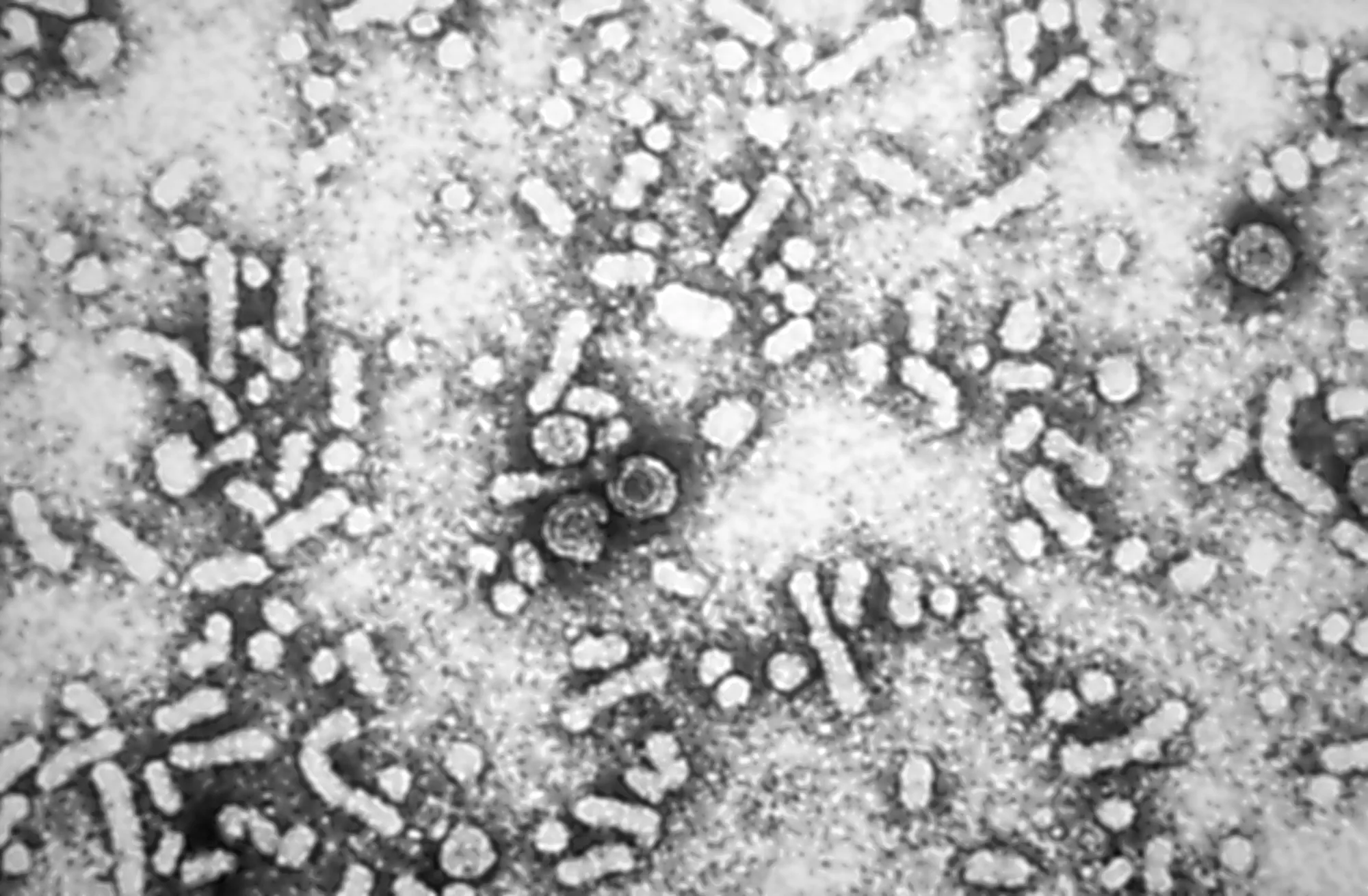 Hepatitis-B virus&nbsp;revealed in the photomicrograph film.