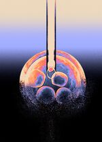In vitro fertilization, illustrated: A microneedle injects sperm into an egg cell.