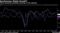 Synchronous Global Growth?