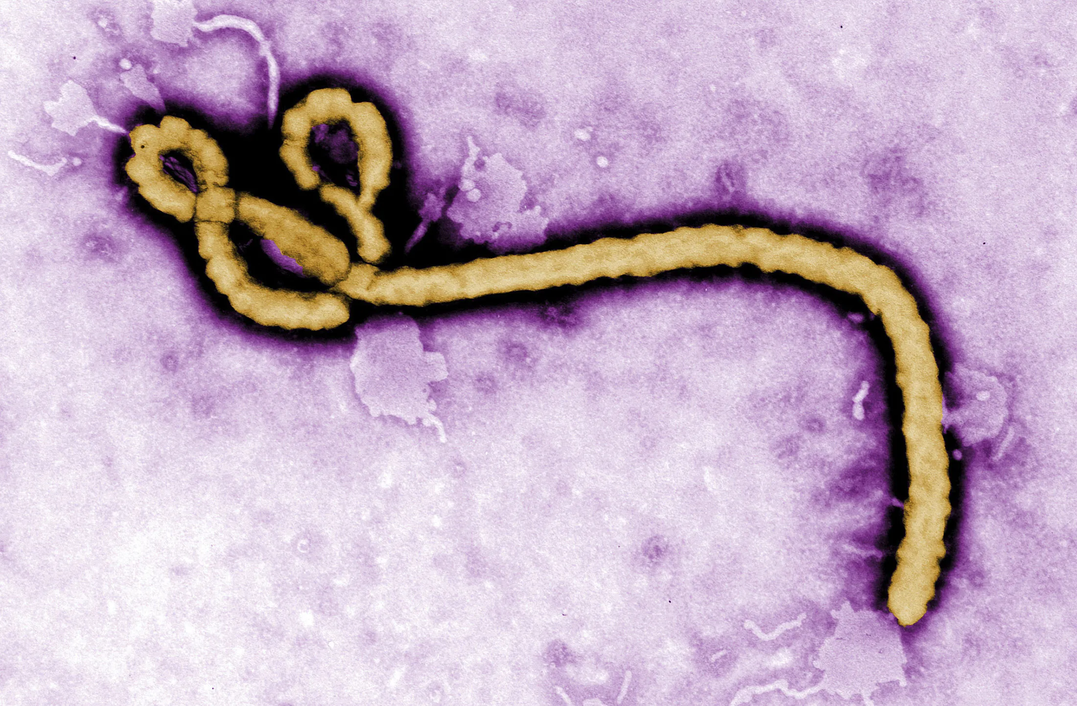 In this undated colorized transmission electron micrograph file image made available by the CDC shows an Ebola virus virion.
