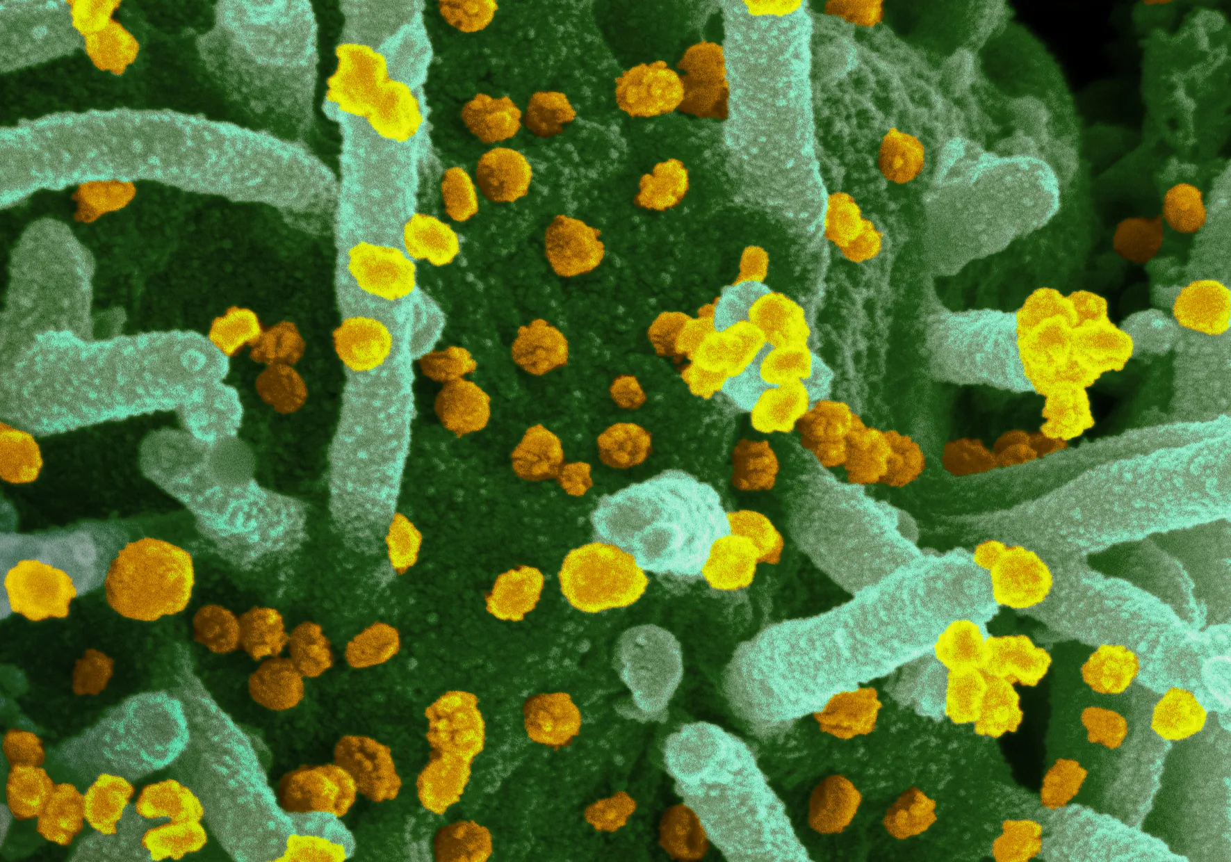 Vaccines have been shown to reduce the concentration of virus particles in the airways of individuals who become infected.