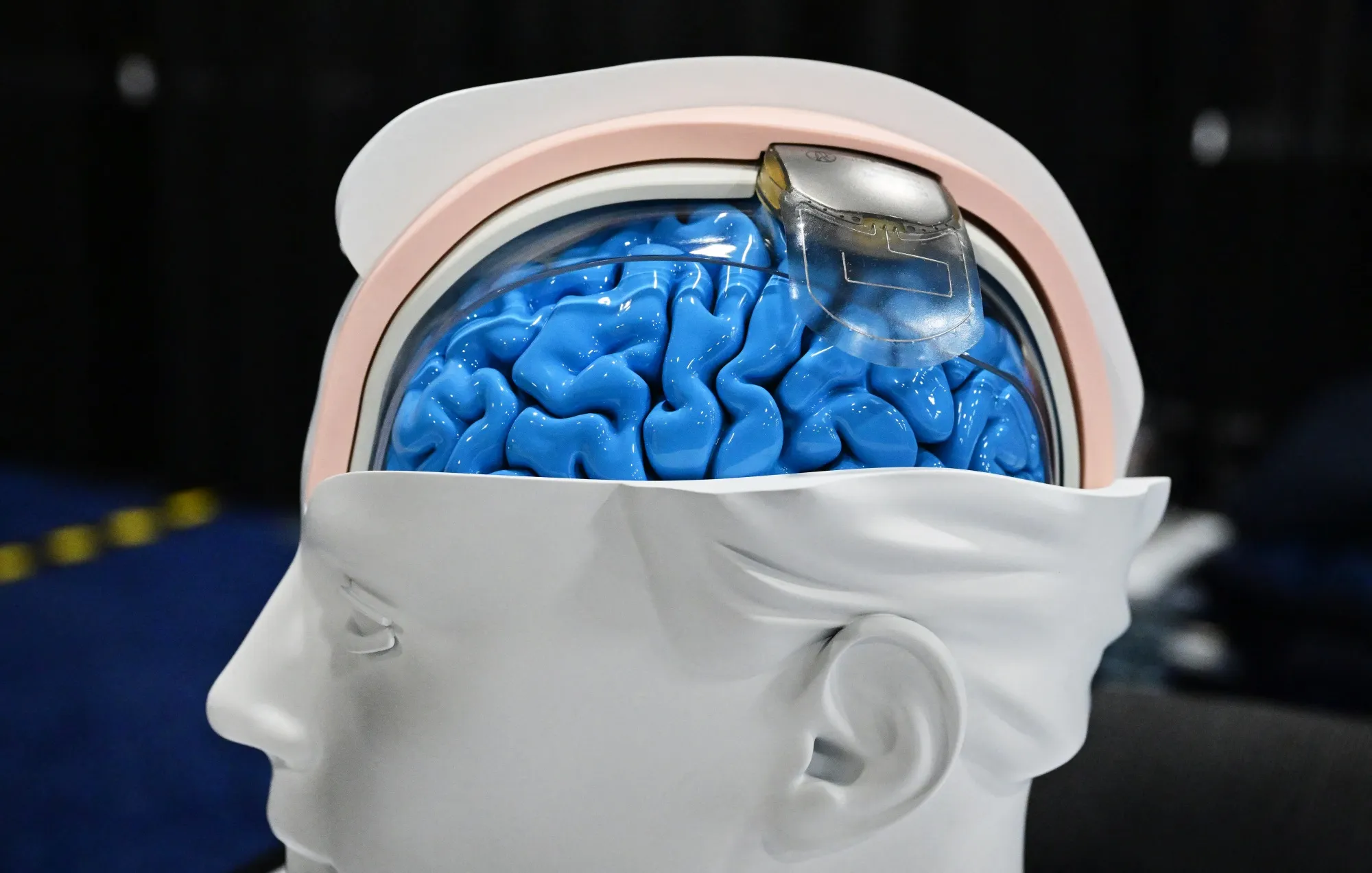 The Implanted Brain Computer-Interface Collaborative Community will work on topics ranging from interoperability to ethics to data privacy.