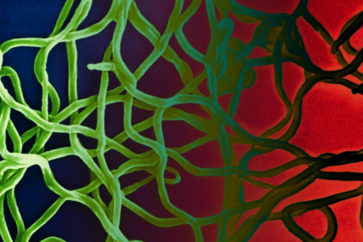 Lyme Disease Dubious Alternative Treatments Are Killing Patients Bloomberg